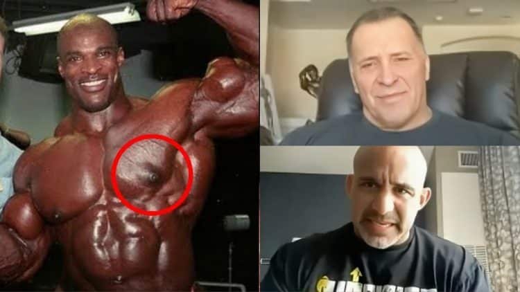 Milos Sarcev, Jose Raymond, Gyno, Gyno surgery gone wrong