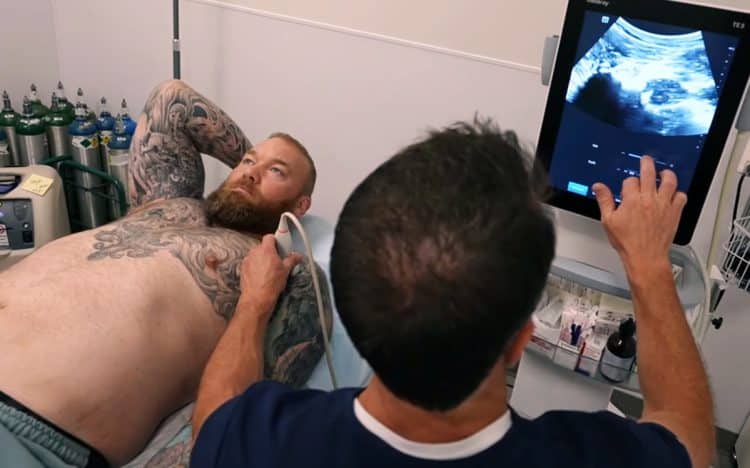 Hafthor Bjornsson Stem Cell Treatment