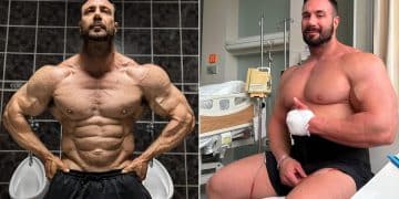 Noel Deyzel Recovering From Surgery